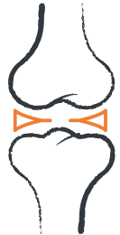 An illustration of a knee joint with orange lines to show the join