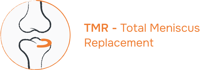 TMR - Total Meniscus Replacement